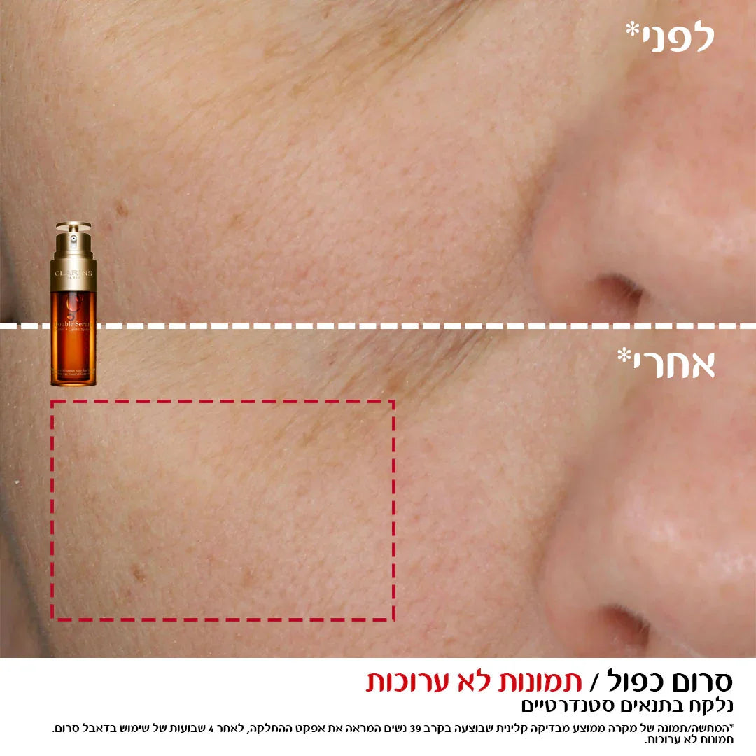 לפני ואחרי שימוש בסרום של קלרינס, שיפור מראה העור, ב-CHOZEN קבוצת אלפא