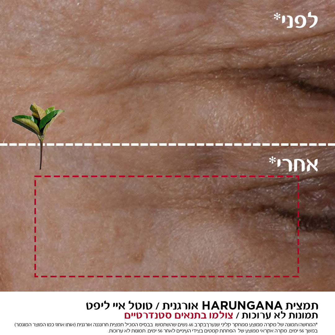 לפני ואחרי טיפול אנטי אייג'ינג לעור, שיפור קמטים ומרקם, תמונת קלוז אפ עור הפנים