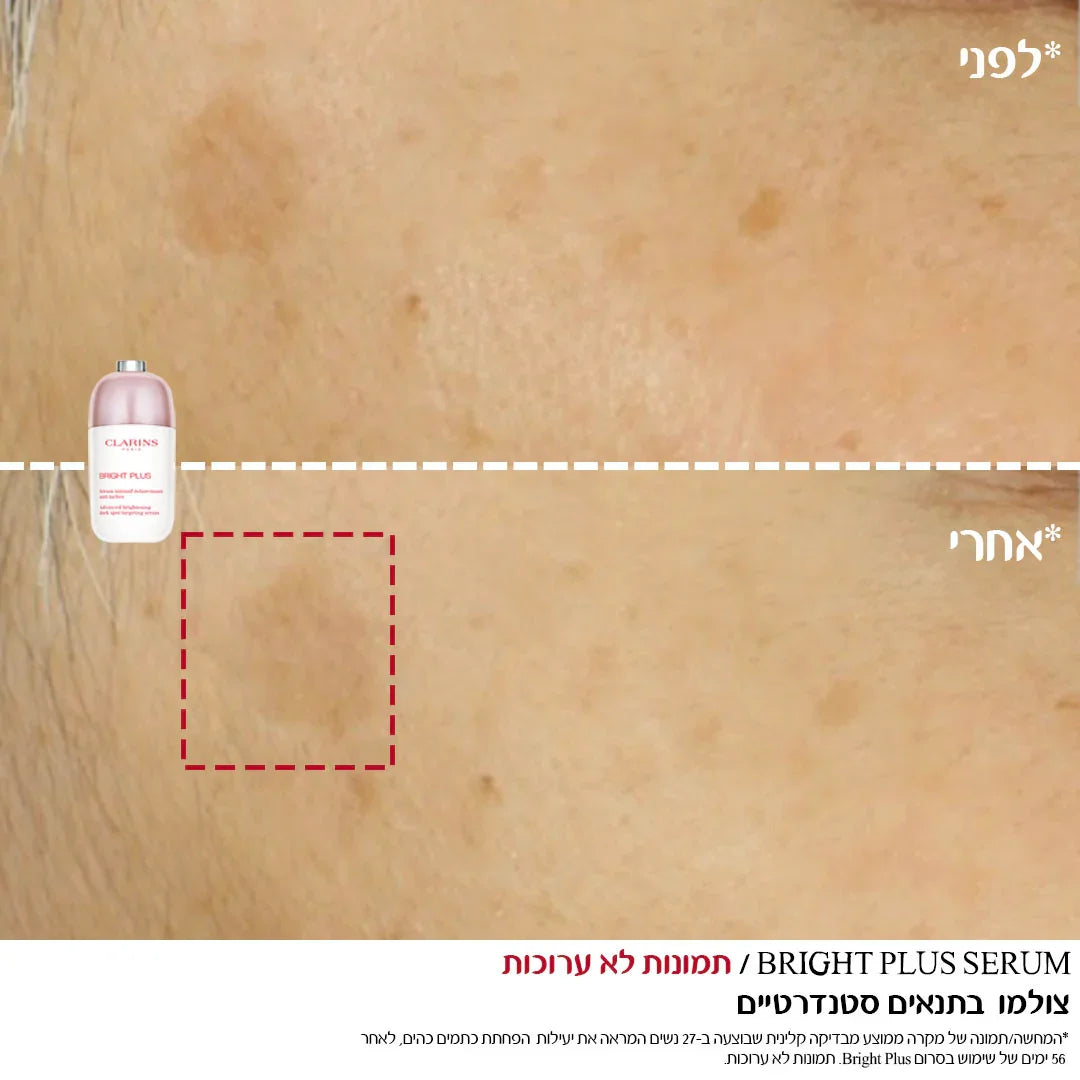 לפני ואחרי טיפול בסרום Clarins, שיפור בגוון העור, מוצר טיפוח HOMEPAGE CHOZEN