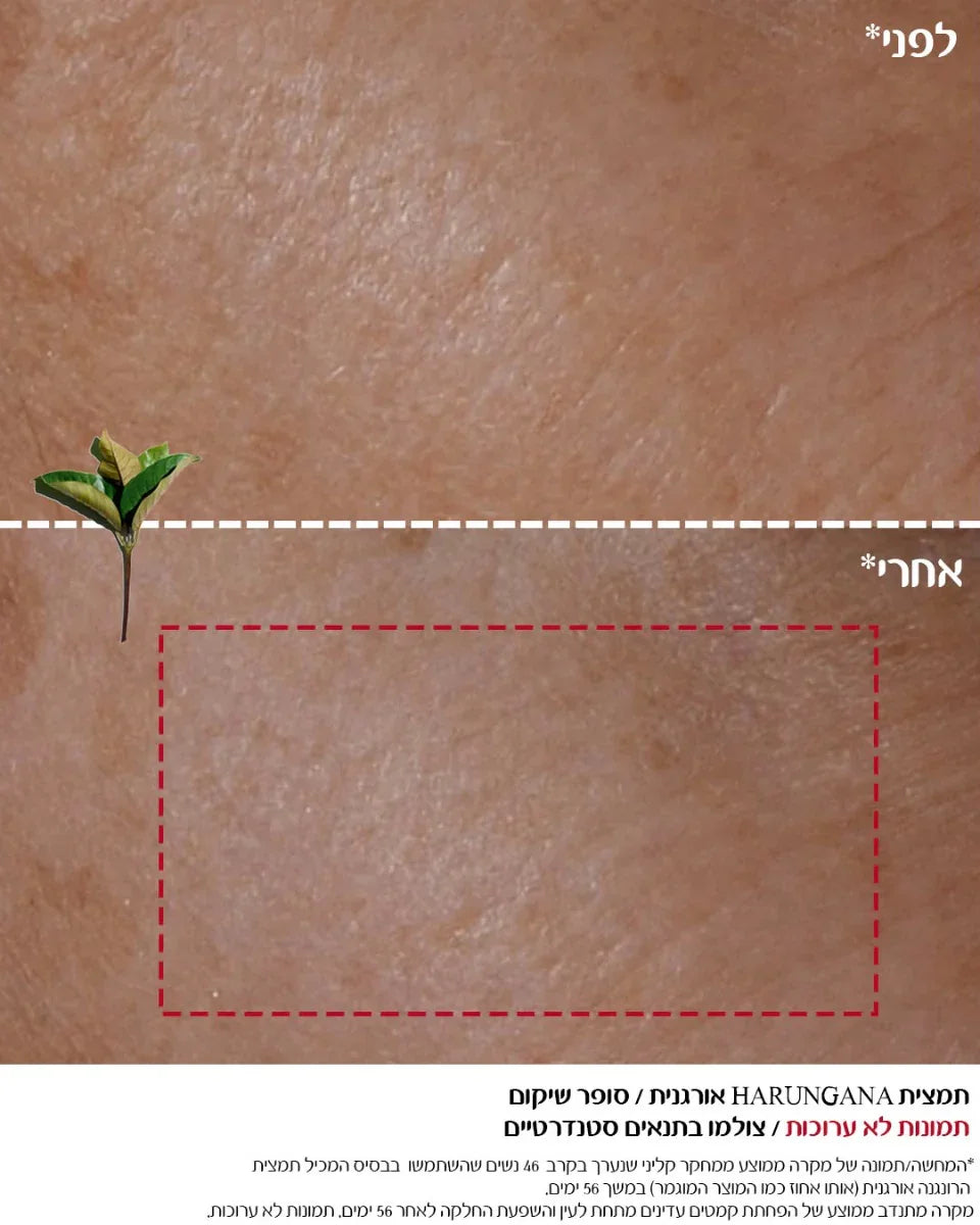 תמונת לפני ואחרי של עור פנים, שיפור במרקם העור, מוצר טיפוח CHOZEN, קבוצת אלפא