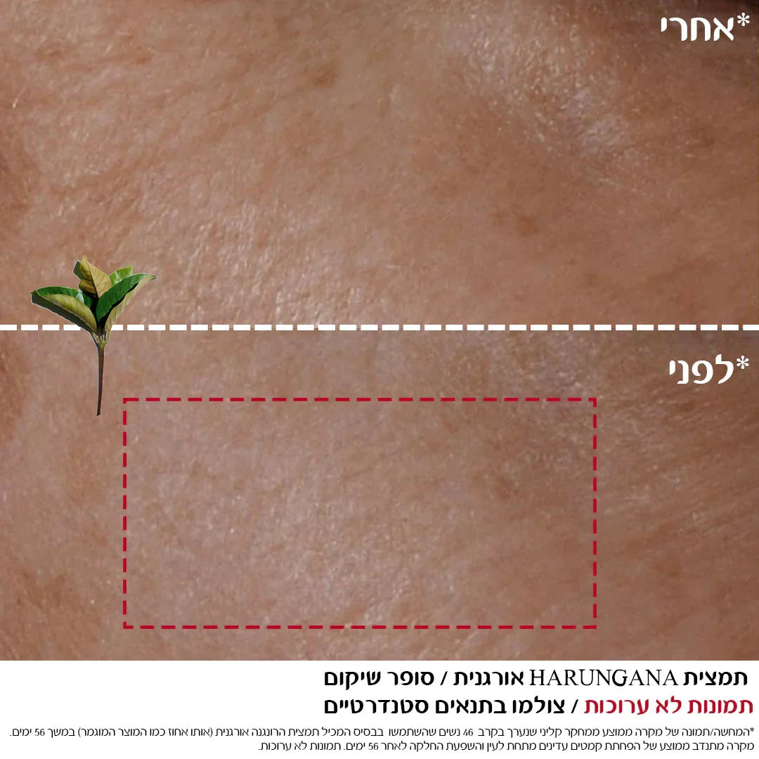 תמונת לפני ואחרי של עור פנים, שיפור טקסטורה, מוצר טיפוח CHOZEN, מותגים מובילים