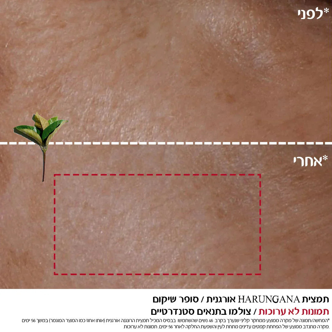 השוואת לפני ואחרי של עור פנים, שיפור מרקם, מוצר טיפוח מבית CHOZEN