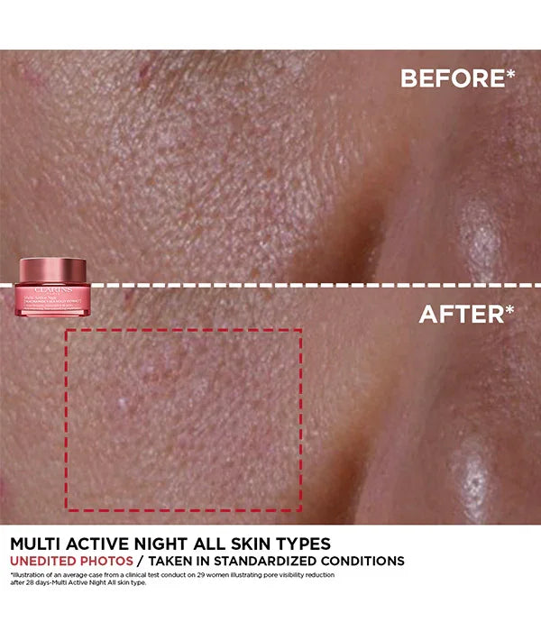 לפני ואחרי שימוש בקרם לילה של קלרינס, מראה עור הפנים, תוצאה משופרת, CHOZEN מותגים מובילים