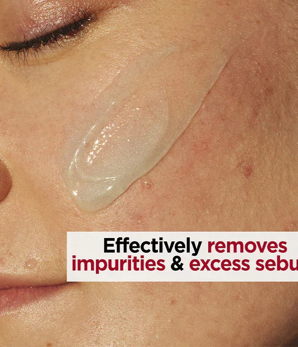 קרם ניקוי לעור הפנים על לחי עם טקסט המציג הסרת לכלוך ושומן, CHOZEN מותגים מובילים