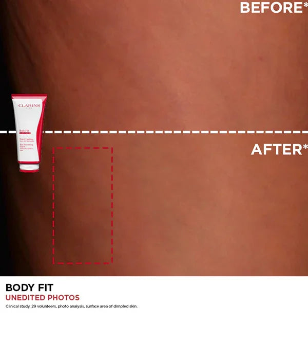 לפני ואחרי שימוש בקרם CLARINS BODY FIT, שיפור מראה עור בגוף, מיתוג CHOZEN