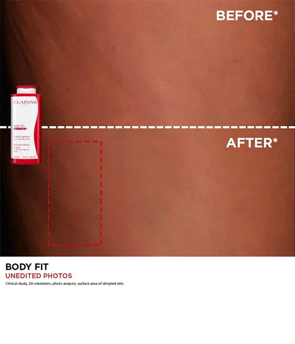 השוואת עור לפני ואחרי שימוש בקרם גוף Clarins Body Fit, קמפיין CHOZEN