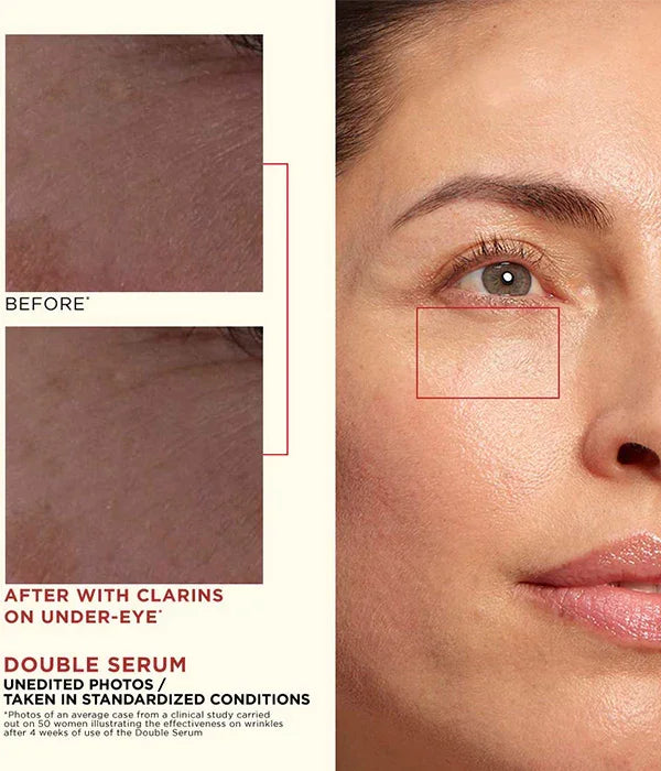 לפני ואחרי שימוש בסרום לעיניים Clarins, קמטים מופחתים בעור הפנים, מומלץ באתר CHOZEN