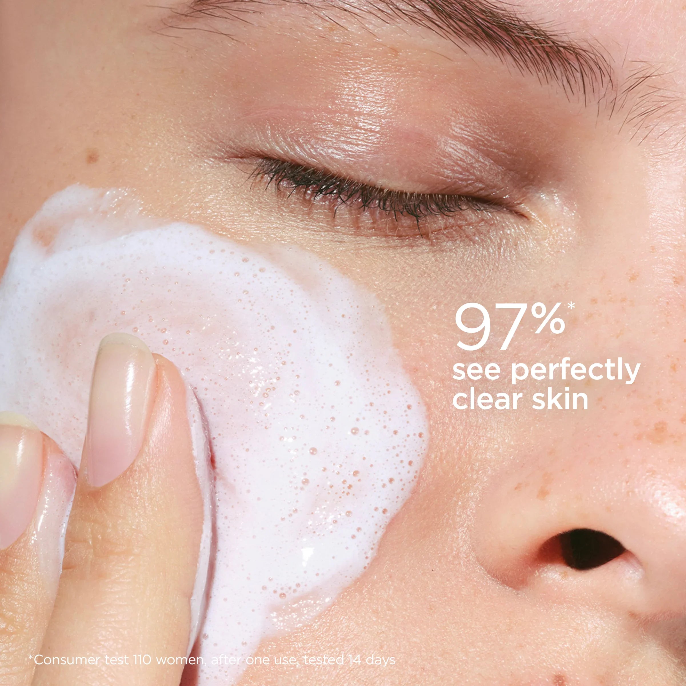 אישה מנקה את הפנים עם קצף עדין, עור חלק, טיפוח, CHOZEN, המותגים המובילים