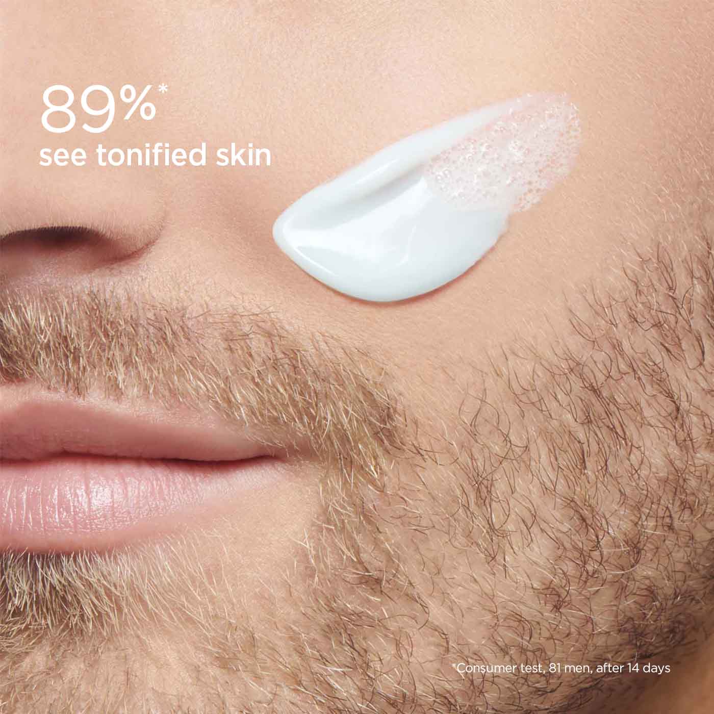 קרם לחות לפנים על לחי של גבר עם זיפים, טיפוח עור, תוצאה משופרת לעור מטופל